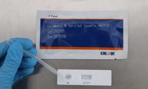 Leishmania Ac test rápido
