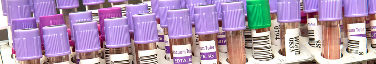 Img. Bioquímica Suero